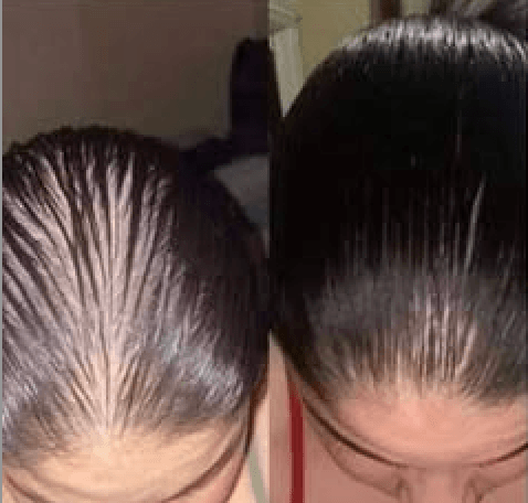 Custom Growth Boosting Scalp Oil (per la cute) - ILYBELLE