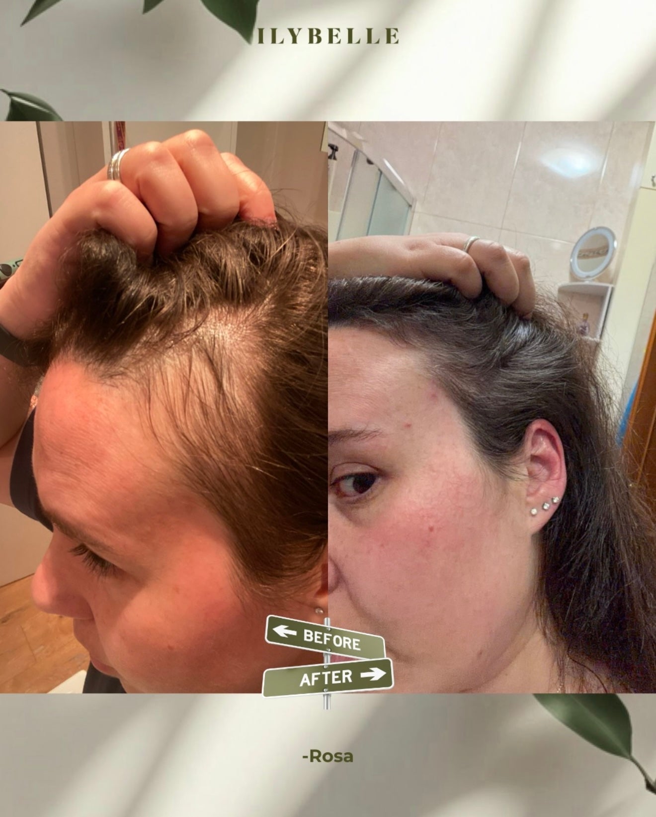 Growth Boosting Scalp Oil  | Olio per la cute