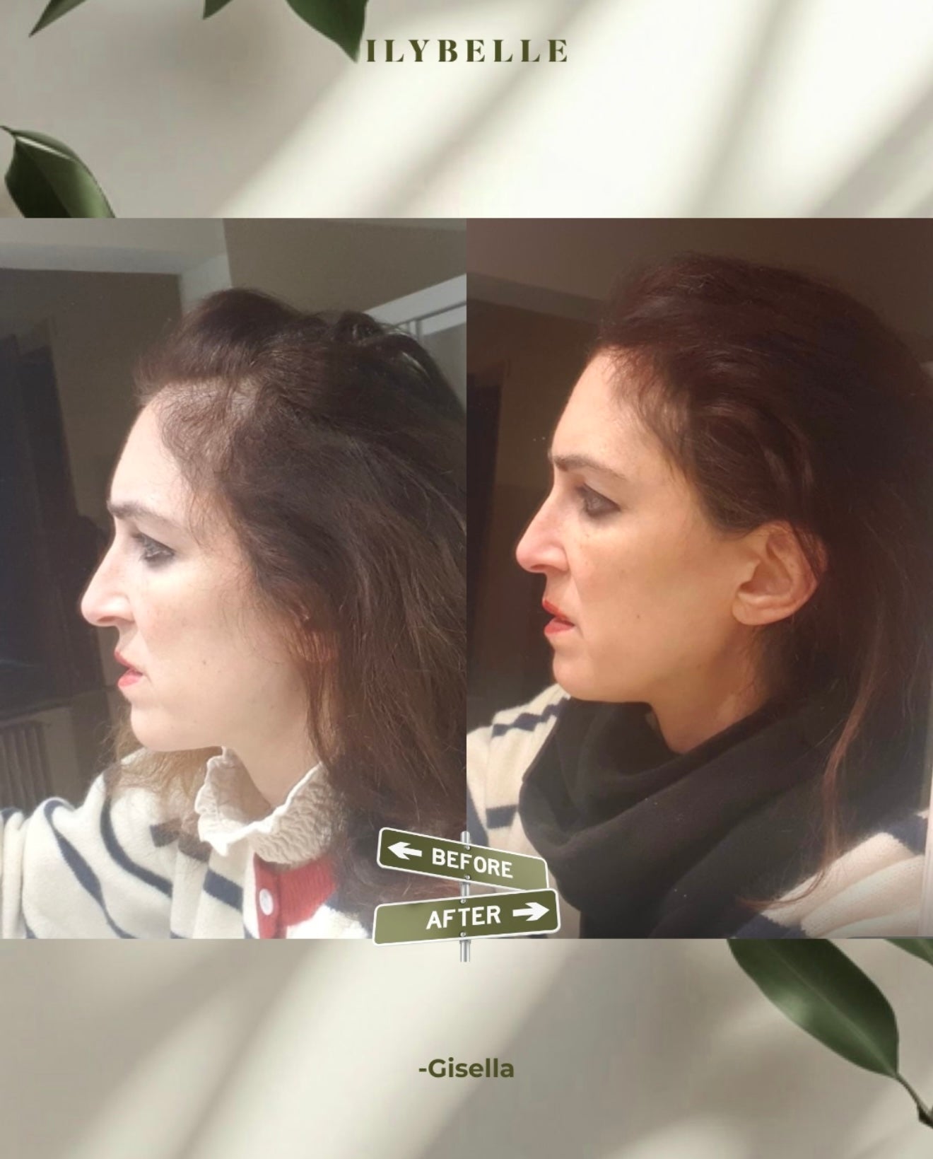 Growth Boosting Scalp Oil  | Olio per la cute