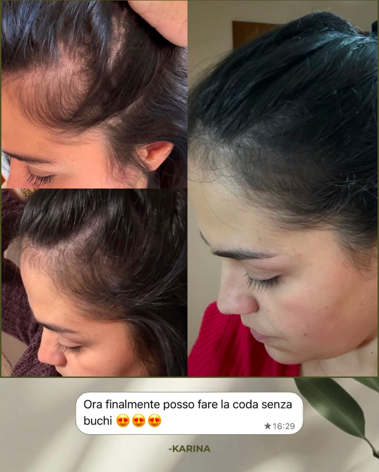 Growth Boosting Scalp Oil  | Olio per la cute